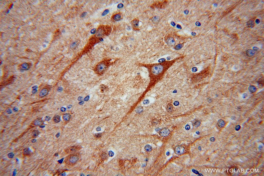 IHC staining of human brain using 16883-1-AP