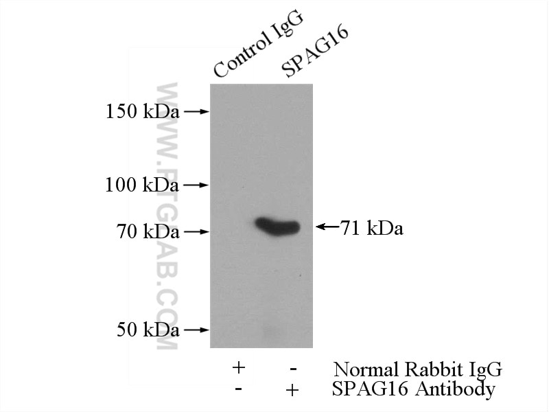 Immunoprecipitation (IP) experiment of mouse testis tissue using SPAG16 Polyclonal antibody (16883-1-AP)