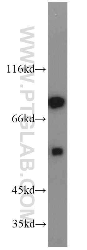 Western Blot (WB) analysis of mouse testis tissue using SPAG16 Polyclonal antibody (16883-1-AP)