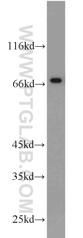 Western Blot (WB) analysis of rat testis tissue using SPAG16 Polyclonal antibody (16883-1-AP)