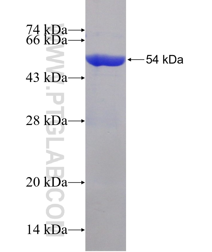 SPAG16 fusion protein Ag10348 SDS-PAGE