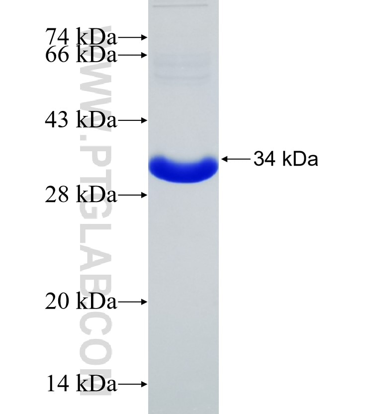 SPAG16 fusion protein Ag10478 SDS-PAGE