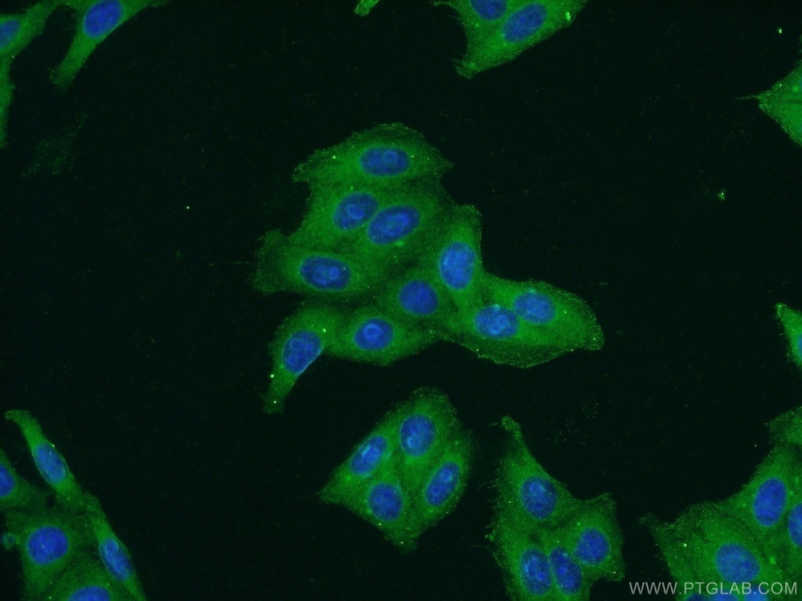 IF Staining of HepG2 using 19721-1-AP