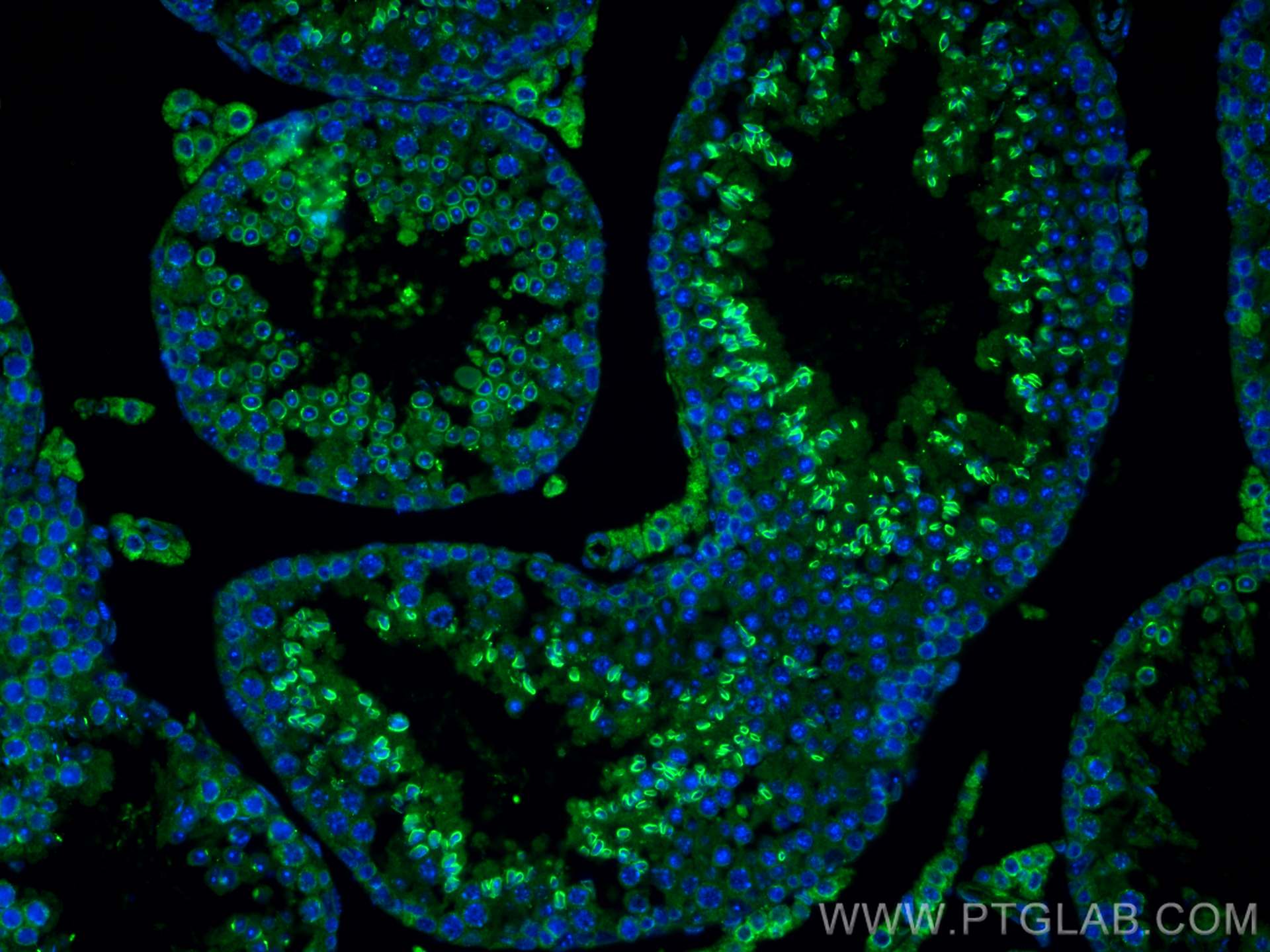 IF Staining of mouse testis using 19721-1-AP