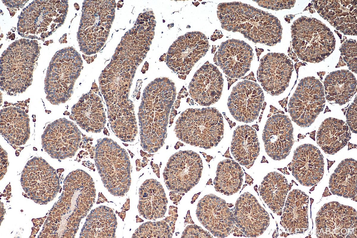 Immunohistochemistry (IHC) staining of mouse testis tissue using SPAG4-Specific Polyclonal antibody (19721-1-AP)