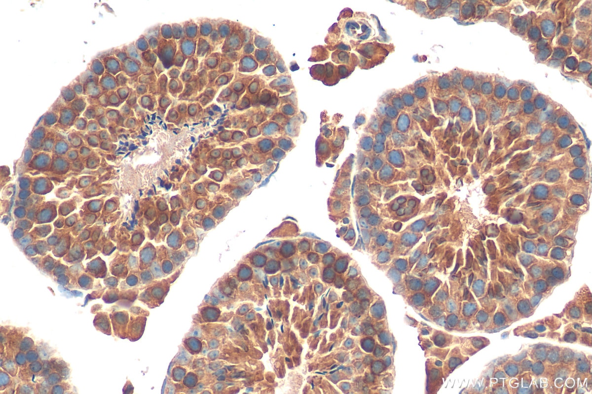 Immunohistochemistry (IHC) staining of mouse testis tissue using SPAG4-Specific Polyclonal antibody (19721-1-AP)