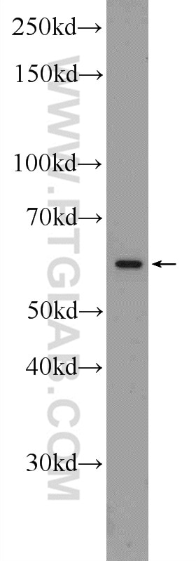 WB analysis of HepG2 using 19721-1-AP