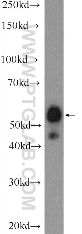 Western Blot (WB) analysis of human testis tissue using SPAG4-Specific Polyclonal antibody (19721-1-AP)