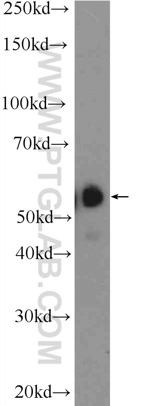 Western Blot (WB) analysis of human testis tissue using SPAG4-Specific Polyclonal antibody (19721-1-AP)