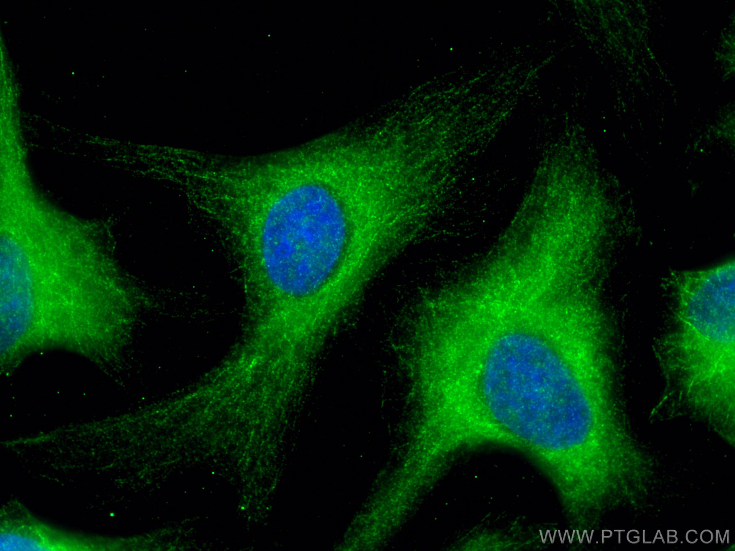 Immunofluorescence (IF) / fluorescent staining of HeLa cells using SPAG5 Polyclonal antibody (14726-1-AP)