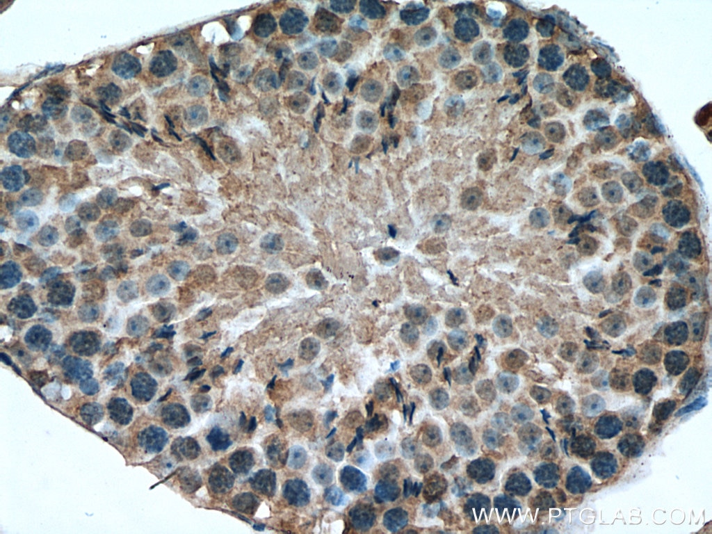 Immunohistochemistry (IHC) staining of mouse testis tissue using SPAG5 Polyclonal antibody (14726-1-AP)
