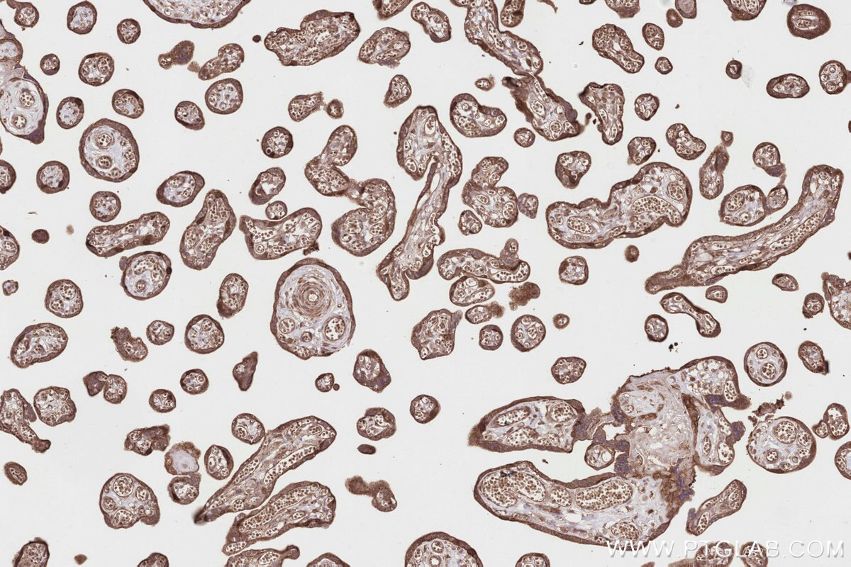 Immunohistochemistry (IHC) staining of human placenta tissue using SPAG5 Polyclonal antibody (14726-1-AP)