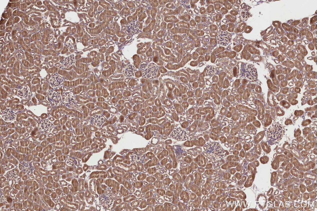Immunohistochemistry (IHC) staining of mouse kidney tissue using SPAG5 Polyclonal antibody (14726-1-AP)