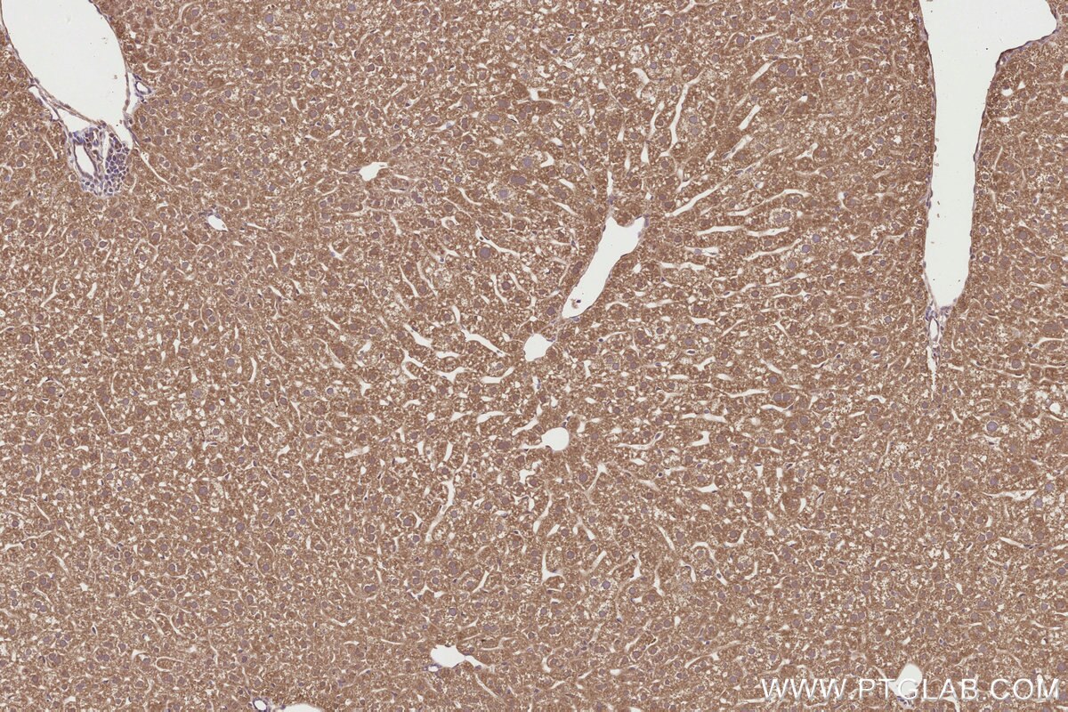 Immunohistochemistry (IHC) staining of mouse liver tissue using SPAG5 Polyclonal antibody (14726-1-AP)