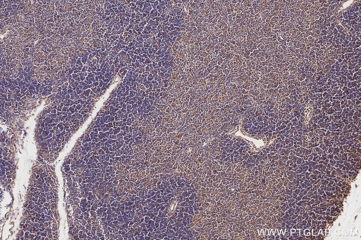 Immunohistochemistry (IHC) staining of mouse thymus tissue using SPAG5 Polyclonal antibody (14726-1-AP)
