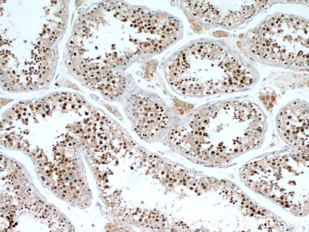 Immunohistochemistry (IHC) staining of human testis tissue using SPAG5 Polyclonal antibody (14726-1-AP)