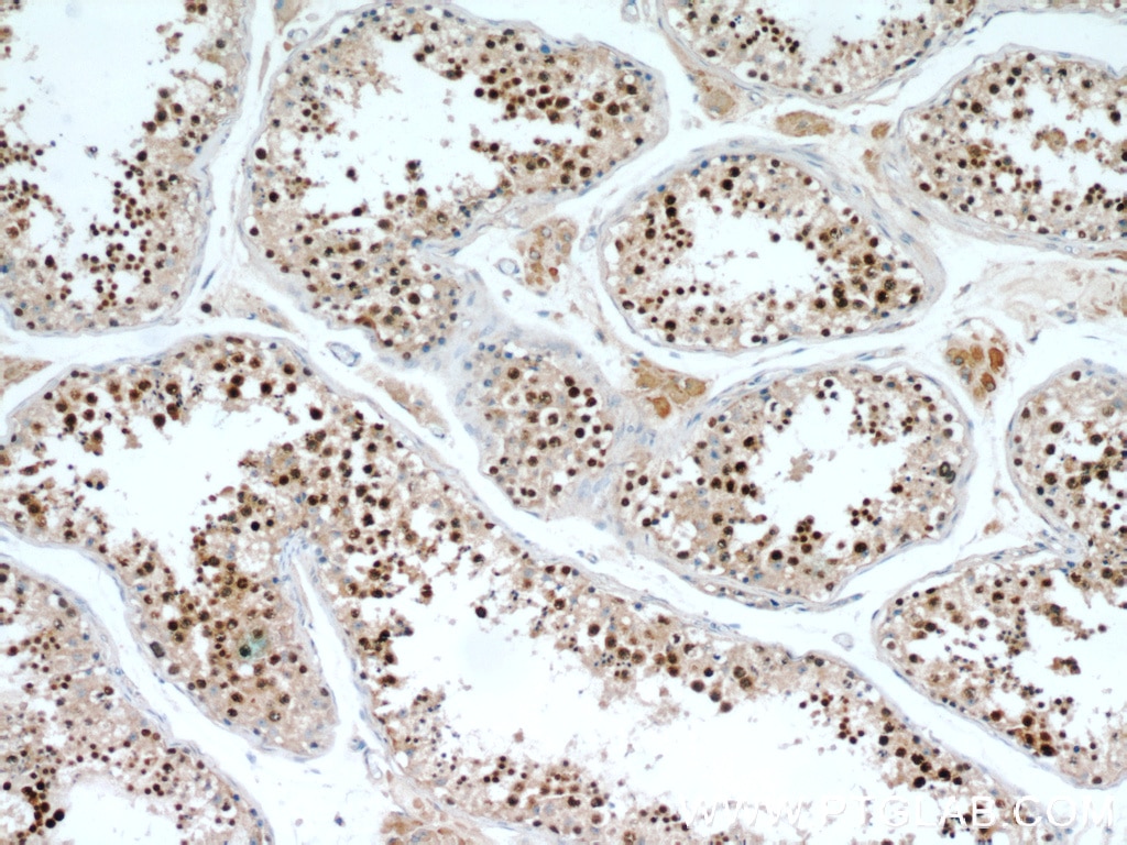 IHC staining of human testis using 14726-1-AP