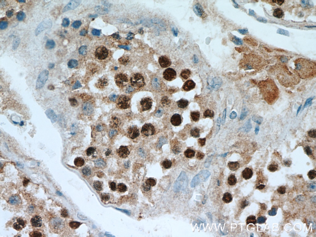 Immunohistochemistry (IHC) staining of human testis tissue using SPAG5 Polyclonal antibody (14726-1-AP)