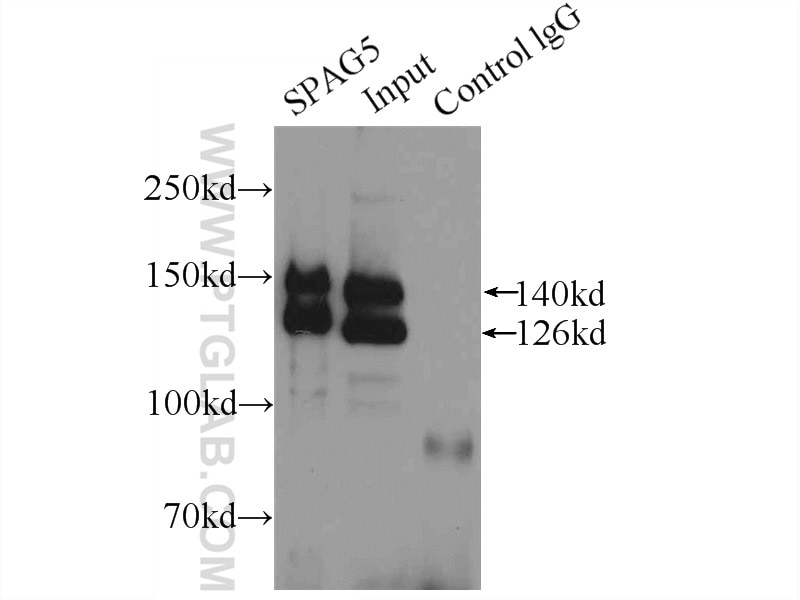 Immunoprecipitation (IP) experiment of HeLa cells using SPAG5 Polyclonal antibody (14726-1-AP)