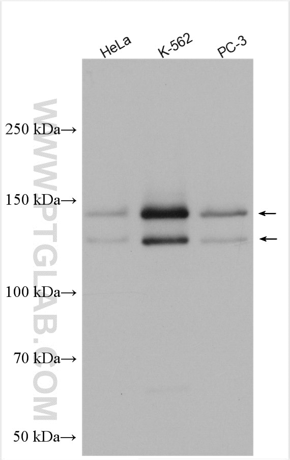 Western Blot (WB) analysis of various lysates using SPAG5 Polyclonal antibody (14726-1-AP)