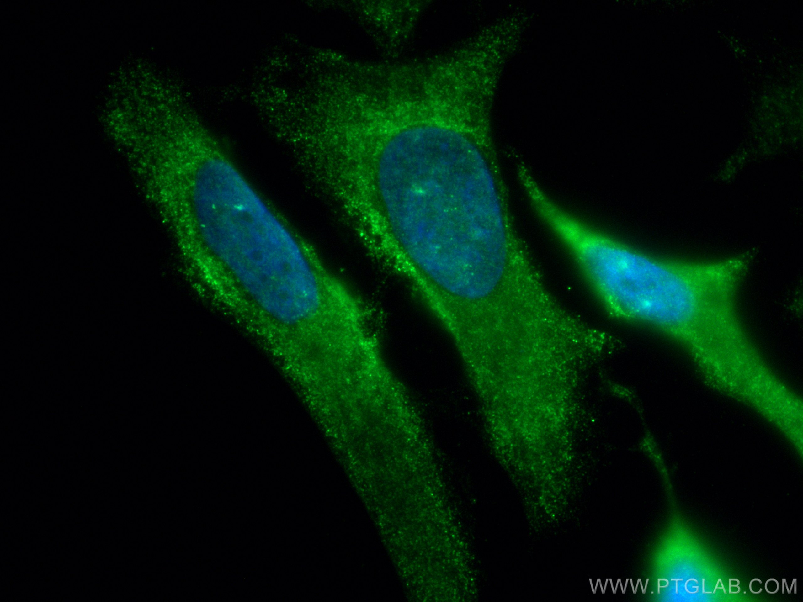 Immunofluorescence (IF) / fluorescent staining of HeLa cells using CoraLite® Plus 488-conjugated SPAG5 Polyclonal ant (CL488-14726)