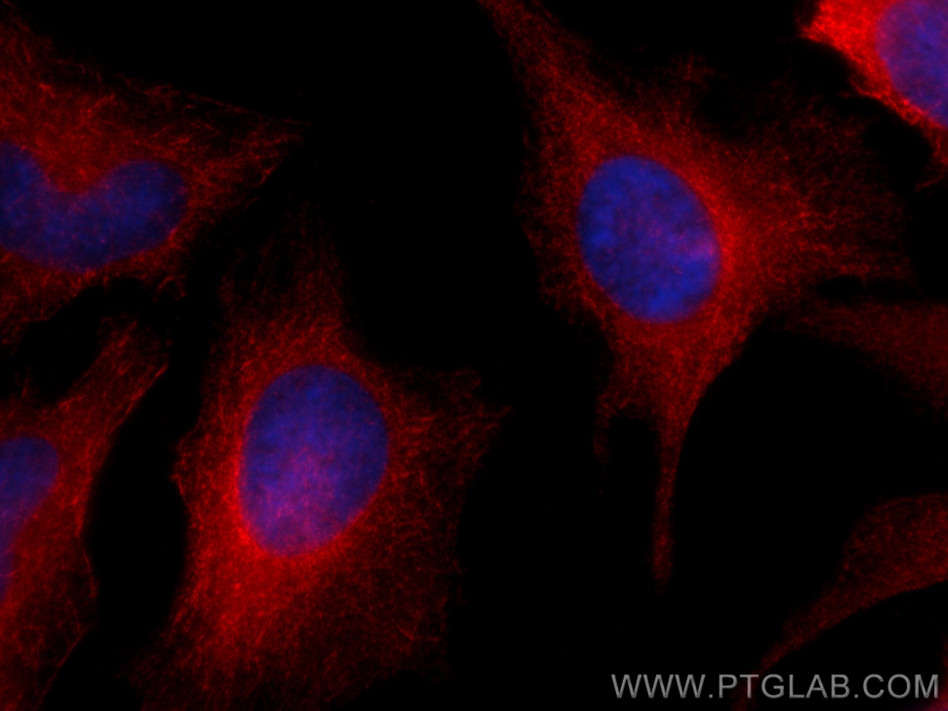 Immunofluorescence (IF) / fluorescent staining of HeLa cells using CoraLite®594-conjugated SPAG5 Polyclonal antibody (CL594-14726)
