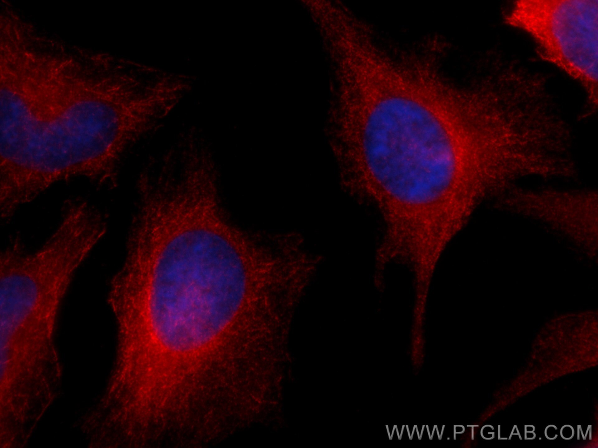 IF Staining of HeLa using CL594-14726