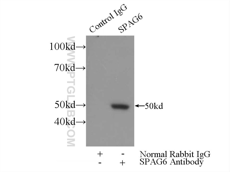 Immunoprecipitation (IP) experiment of mouse testis tissue using SPAG6 Polyclonal antibody (12462-1-AP)