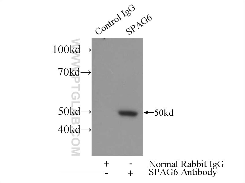 Immunoprecipitation (IP) experiment of mouse testis tissue using SPAG6 Polyclonal antibody (12462-1-AP)