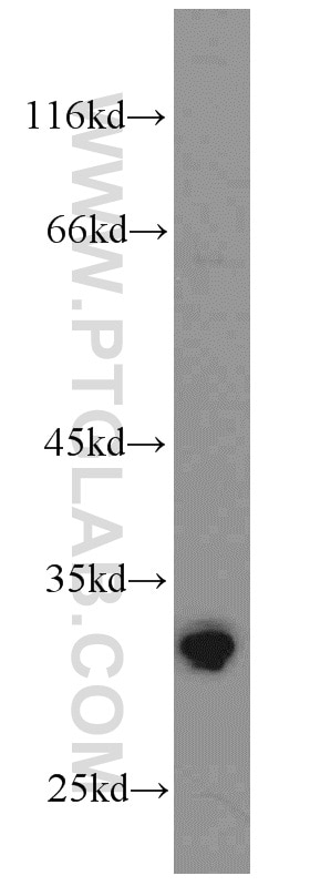 Western Blot (WB) analysis of mouse brain tissue using SPAG7 Polyclonal antibody (16294-1-AP)