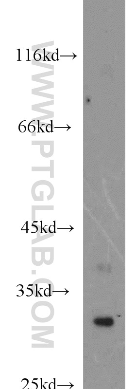 Western Blot (WB) analysis of mouse skeletal muscle tissue using SPAG7 Polyclonal antibody (16294-1-AP)