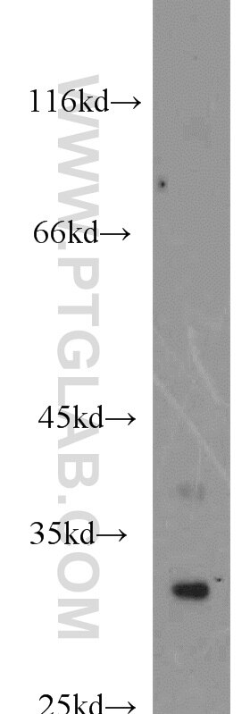 WB analysis of mouse skeletal muscle using 16294-1-AP