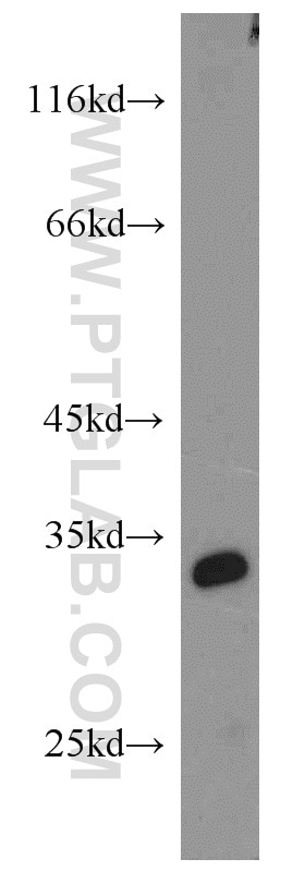 Western Blot (WB) analysis of mouse ovary tissue using SPAG7 Polyclonal antibody (16294-1-AP)
