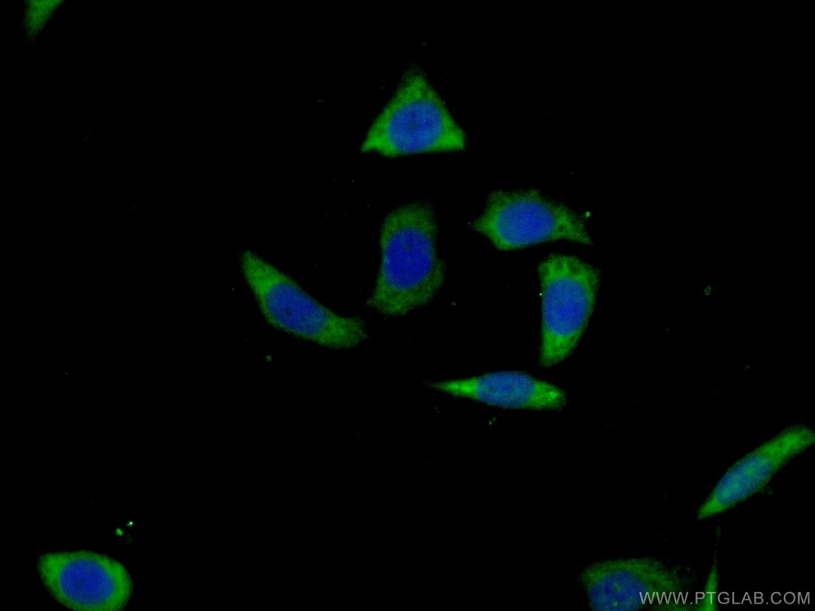 IF Staining of PC-3 using 13915-1-AP