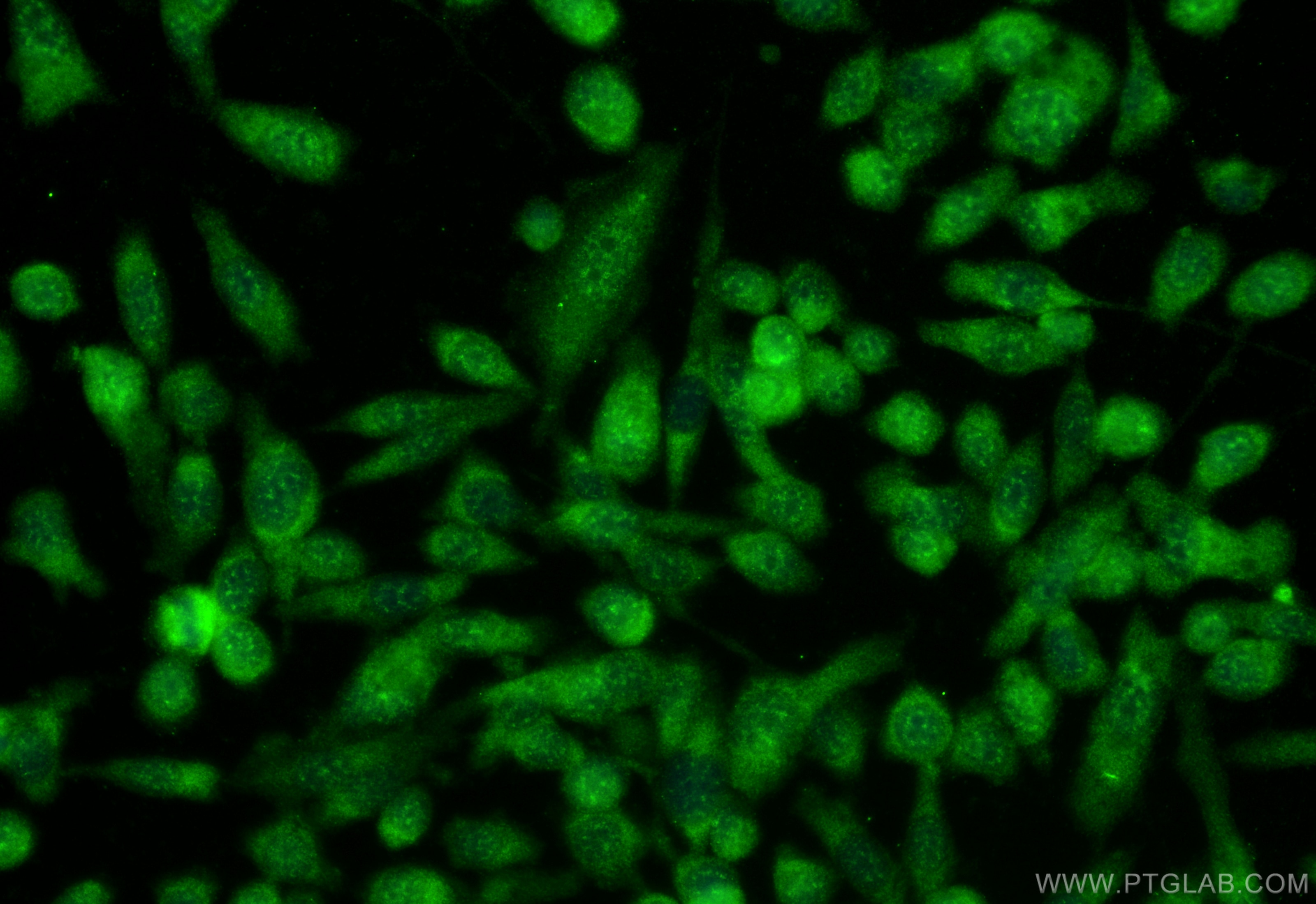 Immunofluorescence (IF) / fluorescent staining of PC-3 cells using SPAG8 Polyclonal antibody (13915-1-AP)