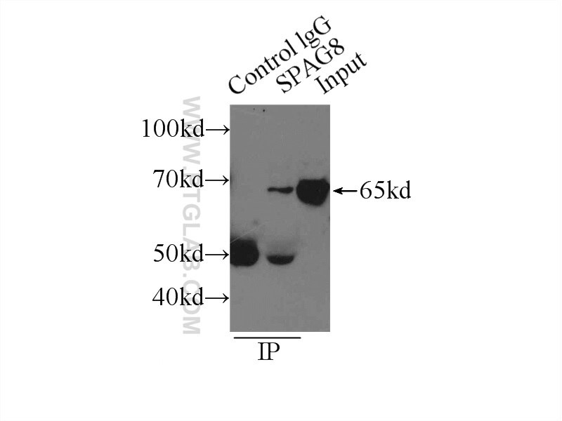 Immunoprecipitation (IP) experiment of mouse testis tissue using SPAG8 Polyclonal antibody (13915-1-AP)