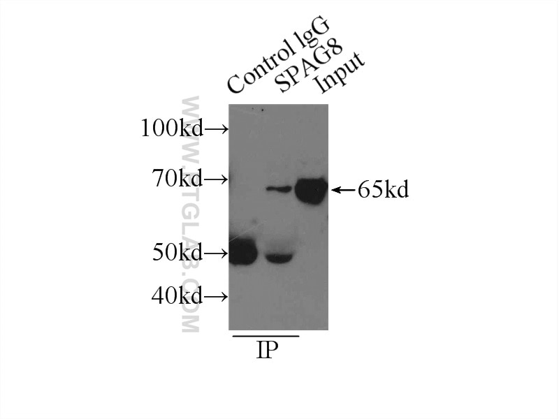 IP experiment of mouse testis using 13915-1-AP