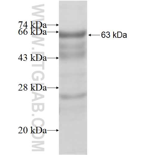 SPAG8 fusion protein Ag4910 SDS-PAGE
