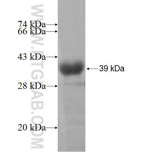 SPAG8 fusion protein Ag5150 SDS-PAGE