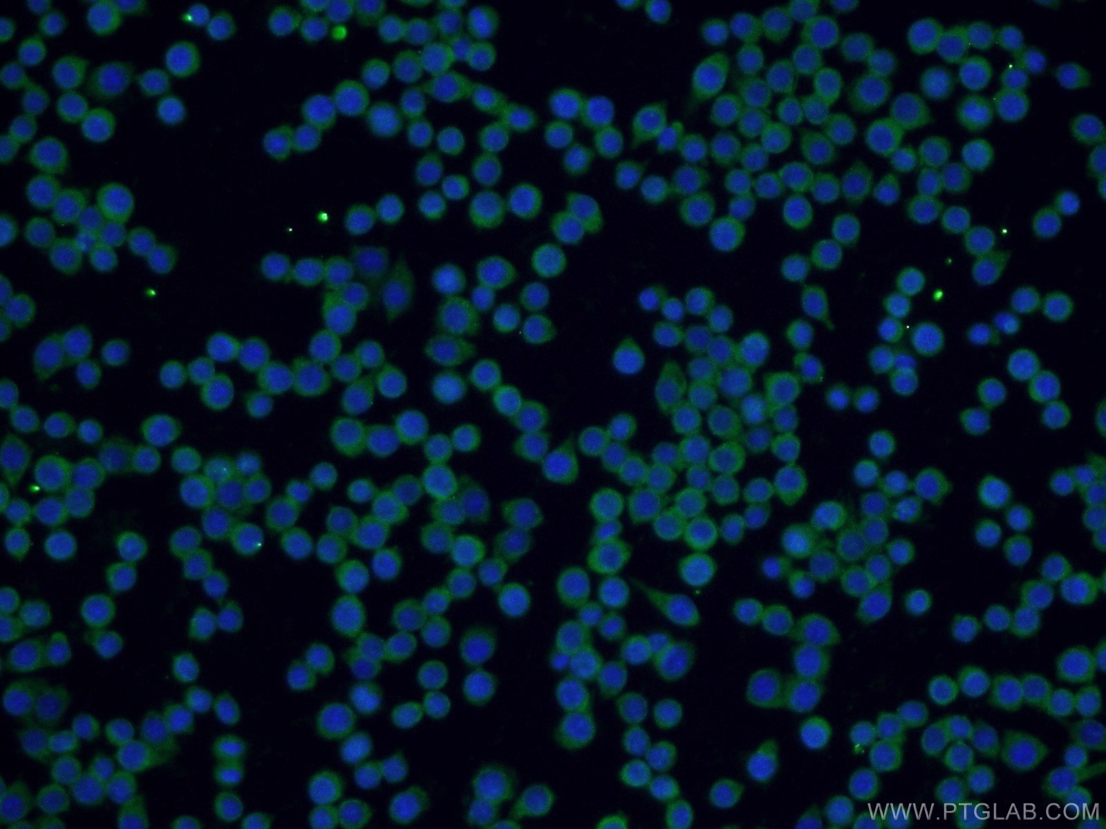 Immunofluorescence (IF) / fluorescent staining of RAW 264.7 cells using SPAG9 Polyclonal antibody (24423-1-AP)