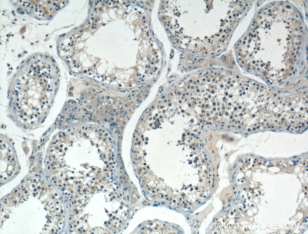 Immunohistochemistry (IHC) staining of human testis tissue using SPAG9 Polyclonal antibody (24423-1-AP)