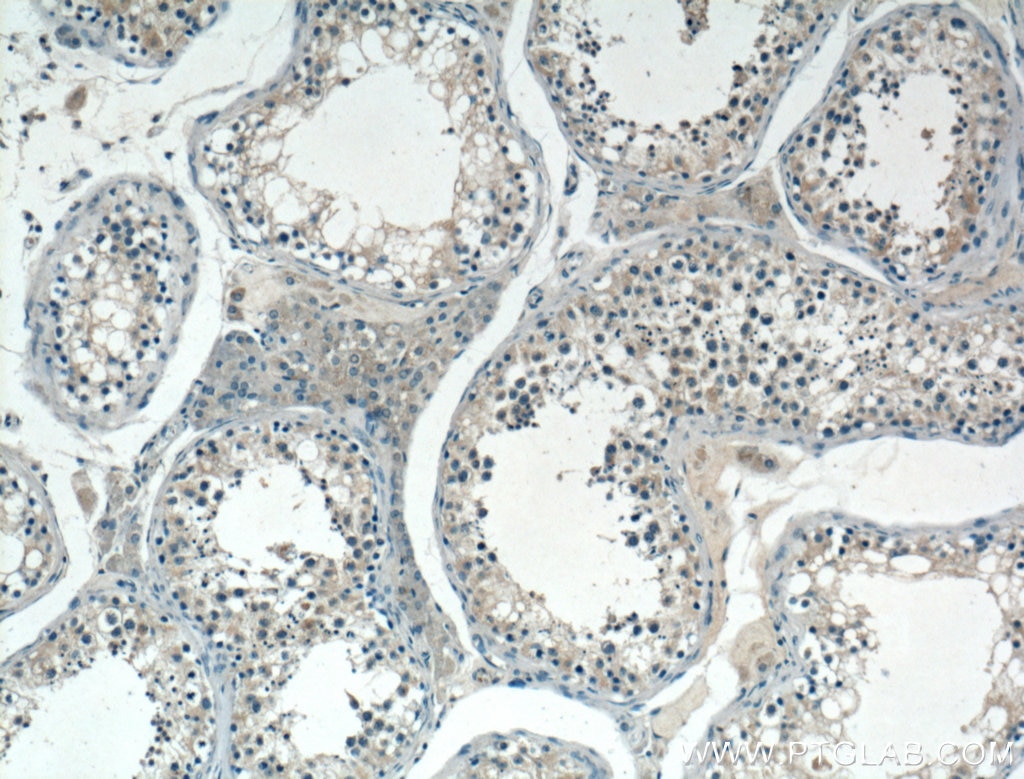 IHC staining of human testis using 24423-1-AP