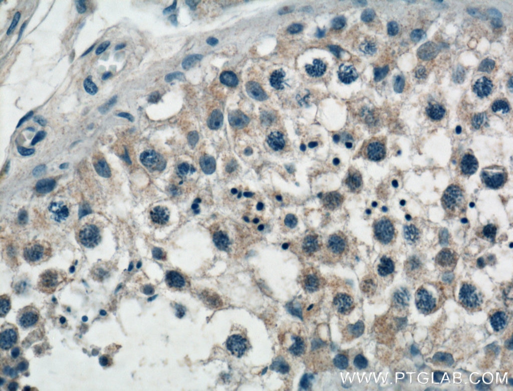 Immunohistochemistry (IHC) staining of human testis tissue using SPAG9 Polyclonal antibody (24423-1-AP)