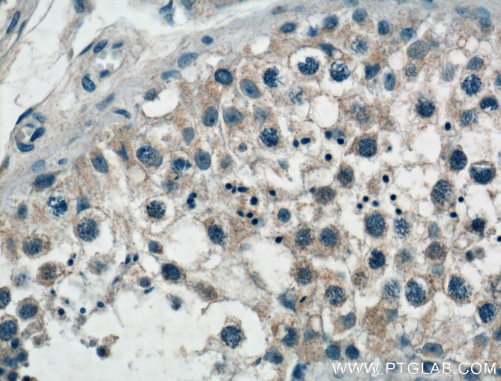 Immunohistochemistry (IHC) staining of human testis tissue using SPAG9 Polyclonal antibody (24423-1-AP)