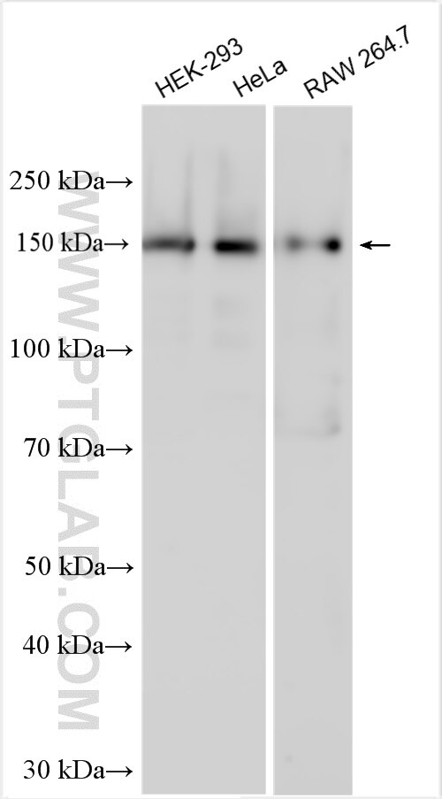 Western Blot (WB) analysis of various lysates using SPAG9 Polyclonal antibody (24423-1-AP)