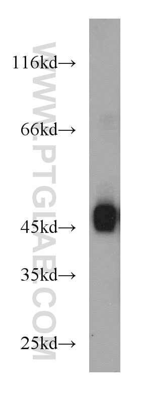 Western Blot (WB) analysis of MCF-7 cells using SPAM1 Polyclonal antibody (11208-1-AP)