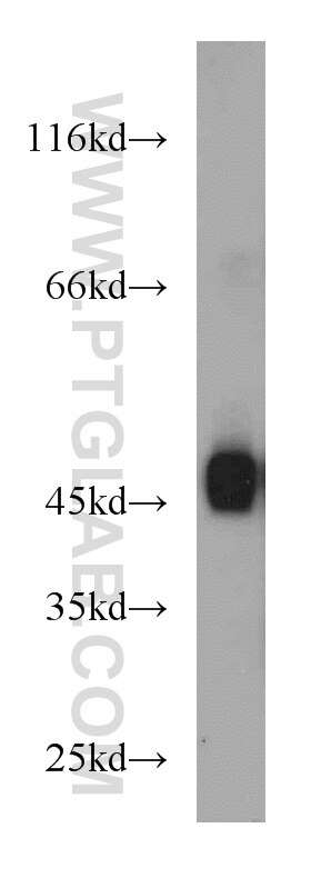 WB analysis of MCF-7 using 11208-1-AP