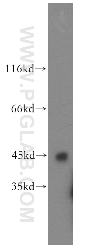 Western Blot (WB) analysis of human testis tissue using SPAM1 Polyclonal antibody (11208-1-AP)