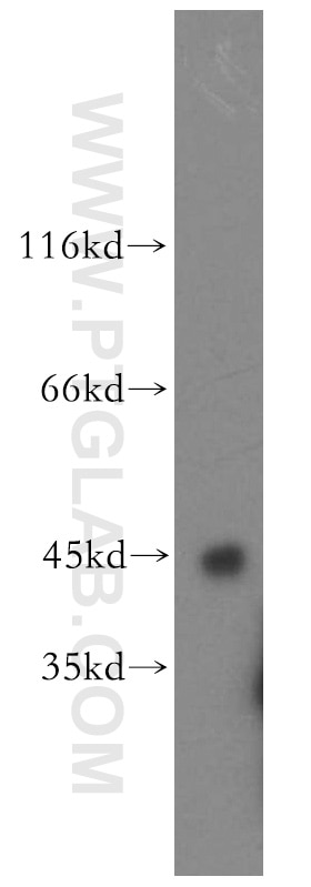 WB analysis of human testis using 11208-1-AP