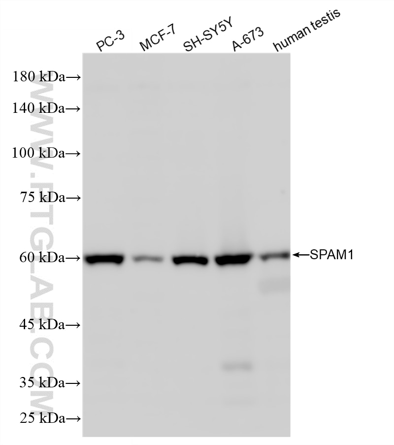 Western Blot (WB) analysis of various lysates using SPAM1 Recombinant antibody (86527-1-RR)